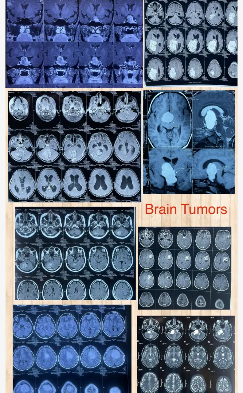 Dr. Abhishek Songara Instagram — Angel Brain & Spine Clinic, Indore