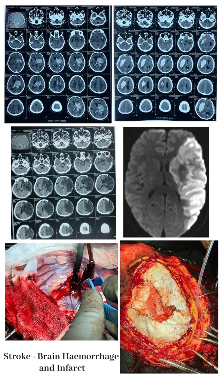 Dr. Abhishek Songara Instagram — Angel Brain & Spine Clinic, Indore