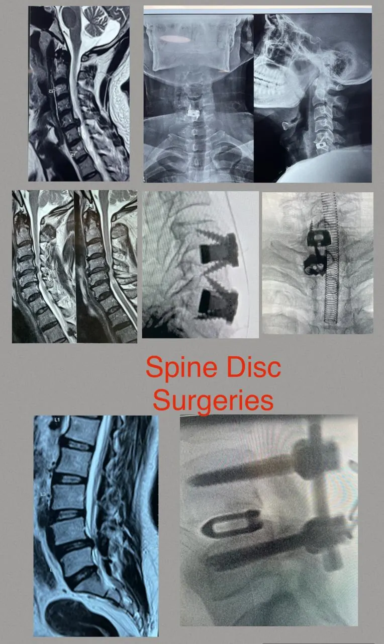 Dr. Abhishek Songara Instagram — Angel Brain & Spine Clinic, Indore