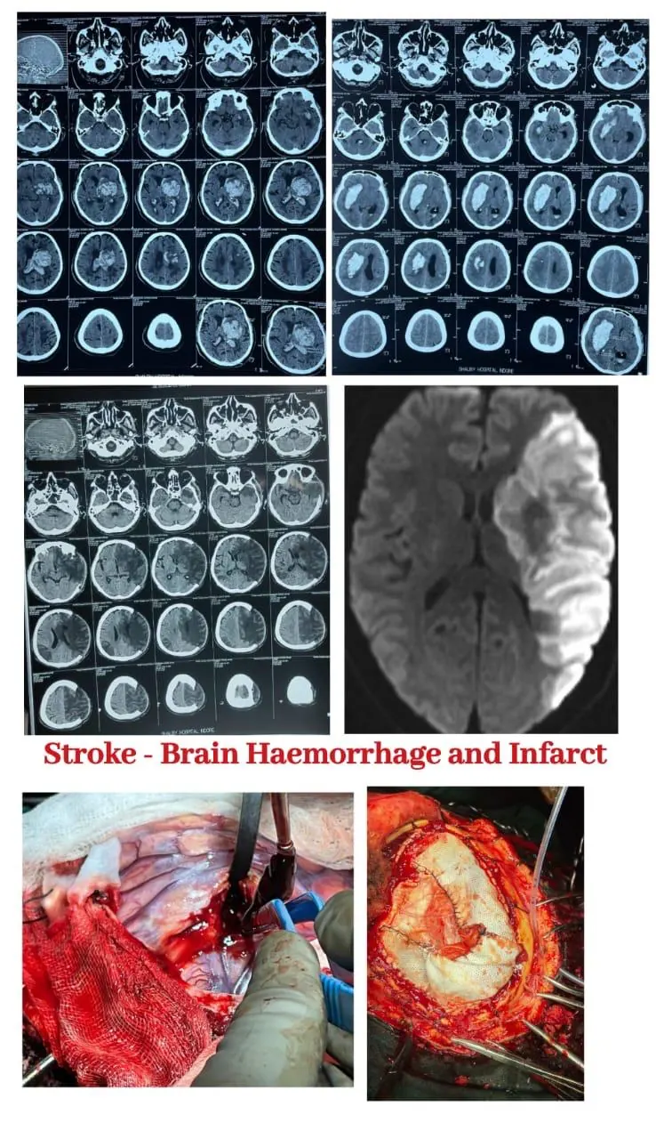 Dr. Abhishek Songara Instagram — Angel Brain & Spine Clinic, Indore