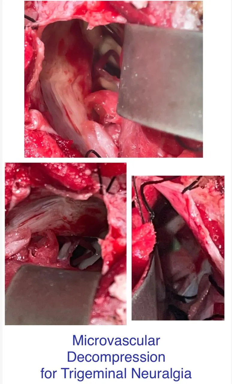 Dr. Abhishek Songara Instagram — Angel Brain & Spine Clinic, Indore
