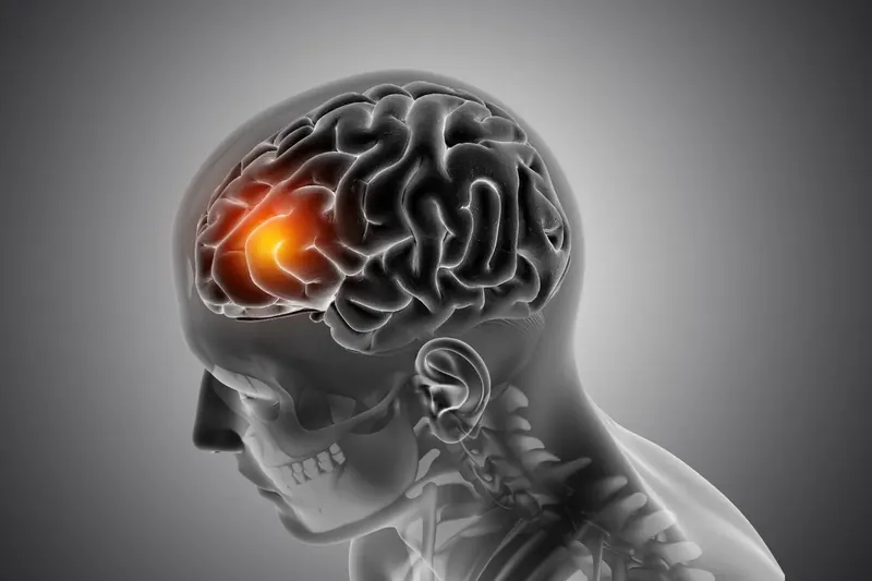 Brain Tumor Surgery in Indore — Dr. Abhishek Songara